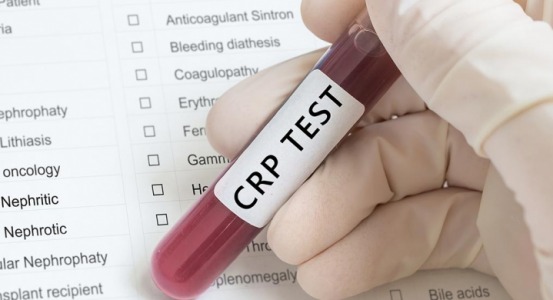 φωτογραφία για crp crp φωτογραφία